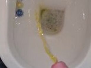 I fucked an alien and now my piss is flourescent yellow!!????